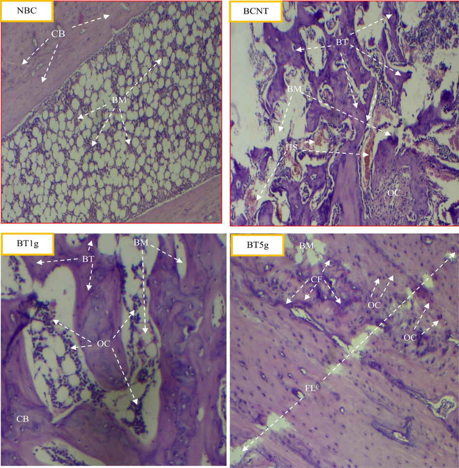 Light photomicrographs show the histological effect of L.sativum seeds on tibial fracture induced in male albino rats after three weeks compared to control groups. NBC = Non-Broken control; BCNT = Broken control-non treated; BT1g = Broken- treated with1g. BT5g = Broken- treated with 5 g. BM = bone marrow. BT = new bone formation. CB = compact bone. CF = collagen fibers. FL = fracture line. HS = Hamate stage. OC = osteocyte.