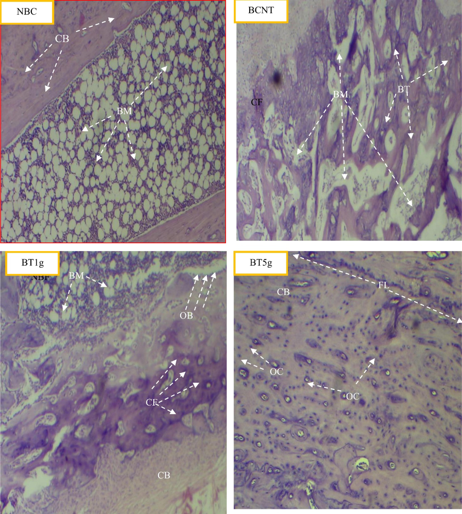 Light photomicrographs show the histological effect of L.sativum seeds on tibial fracture induced in male albino rats after six weeks compared to control groups. NBC = Non-Broken control; BCNT = Broken control-non treated; BT1g = Broken- treated with1g. BT5g = Broken- treated with 5 g. BM = bone marrow; BT = new bone formation; CB = compact bone; CF = collagen fibers; OB = Osteoblast; OC = osteocyte.