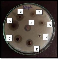 Antimicrobial Well diffusion method for Staphylococcus aureus (Muller Hinton Agar) in various concentrations. Well A- 100 mg/ml, B- 75 mg/ml, C- 50 mg/ml, D- 25 mg/ml, E-12.5 mg/ml, F- Propolis extract, G- Silver nitrate, H- Distilled water.