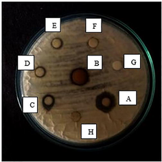 Antimicrobial Well diffusion method for Aspergillus niger (Potato dextrose agar) in various concentrations. Well A- 100 mg/ml, B- 75 mg/ml, C- 50 mg/ml, D- 25 mg/ml, E-12.5 mg/ml, F- Propolis extract, G- Silver nitrate, H- Distilled water.