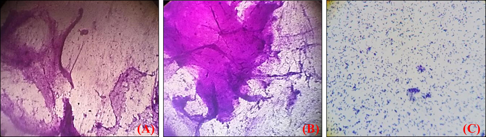 Crystal Violet images of biofilm development (a) Untreated control (b) Listeria monocytogens biofilm with ¼ MIC (c) Biofilm with ½ MIC.