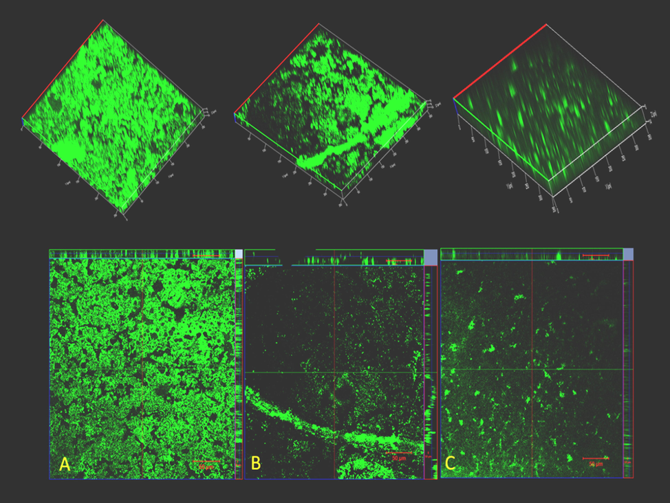 CLSM ortho and 3D images of biofilms of L. monocytogenes development (a) Untreated control (b) Listeria monocytogens biofilm with ¼ MIC (c) Biofilm with ½ MIC.