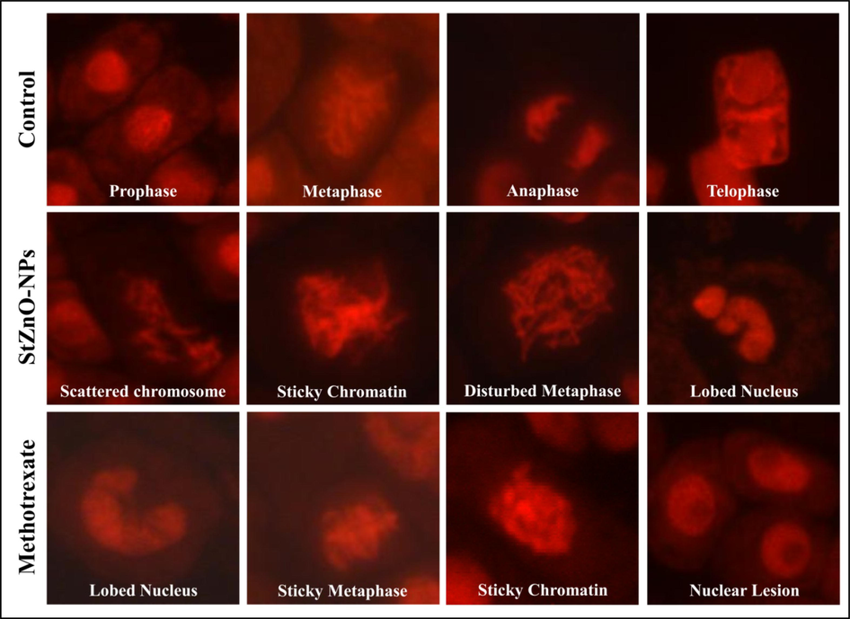 Representative images of genotoxicity of StZnO-NPs observed in onion root meristem cells.