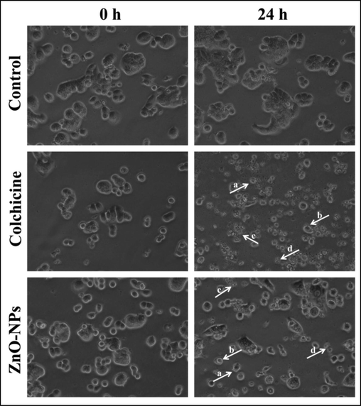 Representative images of morphological changes observed in HT-29 cells upon treatment with StZnO-NPs. (a) Apoptotic bodies; (b) membrane blebbing; (c) nuclear fragmentation; (d) cellular shrinkage.