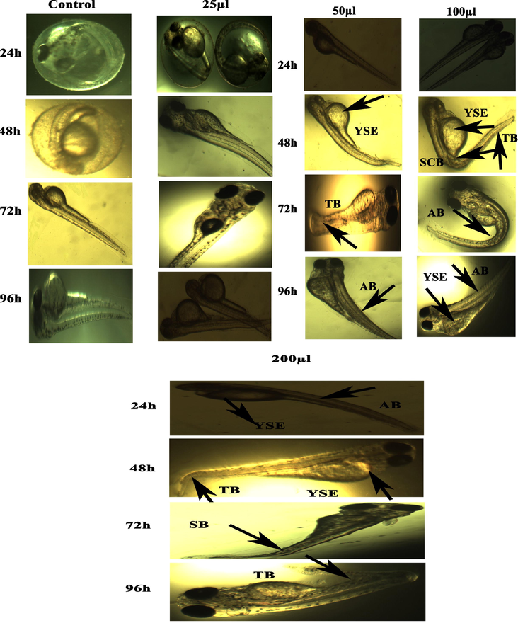 Representative images of zebrafish embryos and larvae exposed to CuO NPs (Chemical). The control group shows the normal appearance at 24 hpf, 48 hpf, 72 hpf, and 96 hpf. Tail bent (TB), yolk sac edema (YSE), head malformation (HM), axis bent (AB) and & tail fold malformation (TFM) denoted the malformation after exposure to 100–200 µl of CuO NPs (Chemical) for 48–96 hpf.