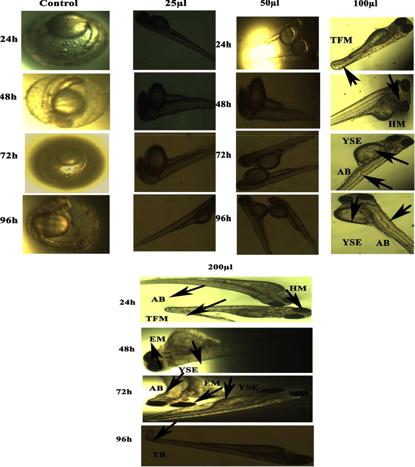 Representative images of zebrafish embryos and larvae exposed to CuO NPs (Green). The control group shows the normal appearance at 24 hpf, 48 hpf, 72 hpf, and 96 hpf. Tail bent (TB), yolk sac edema (YSE), head malformation (HM), axis bent (AB) and & tail fold malformation (TFM) denoted the malformation after exposure to 100–200 µl of CuO NPs (Green) for 48–96 hpf.