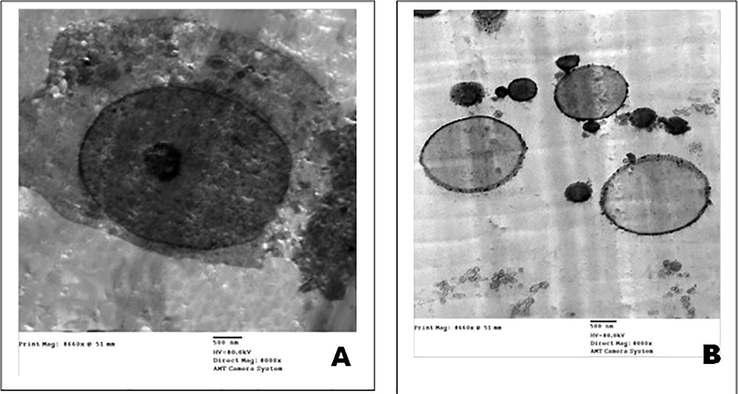 TEM micrographs of the ultrastructural characteristics of MCF-7cells treated with and without cockroach extract. (A) Control MCF-7 cells. (B) MCF-7 cells treated with cockroach extract. (Scale bar = 500 nm).