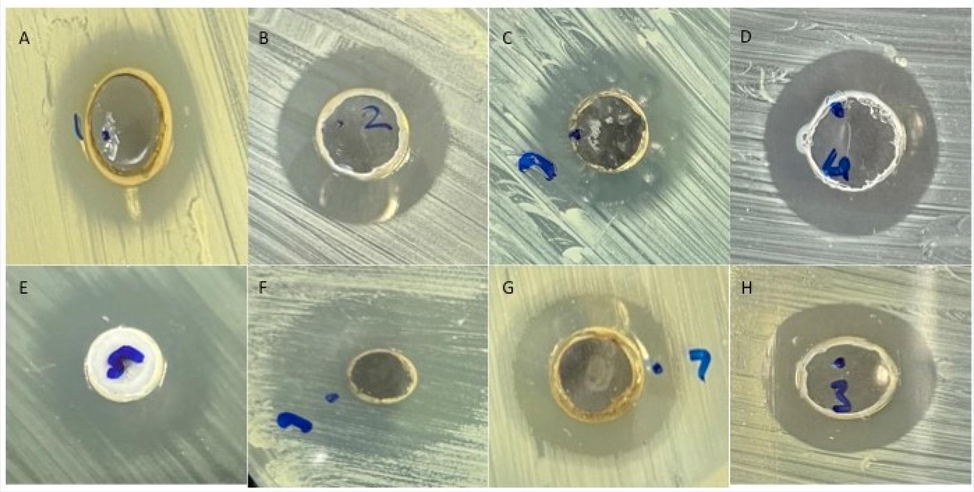 Effect of ZnO NP against Gram negative and Gram positive bacterial strains. Formation of zone of inhibition (A) Pseudomonas aeruginosa (B) Escherichia coli (C) Klebsiella pneumoniae (D) Salmonella (E) Staphylococcus aureus (F) Staphylococcus saprophyticus (G) Streptococcus pyogenes and (H) Enterococcus faecalis.