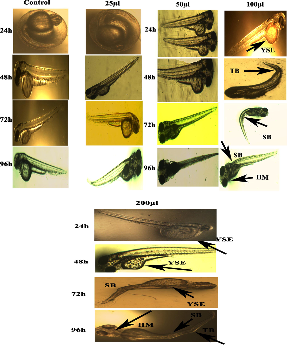 Representative images of zebrafish embryos and larvae exposed to CuONC. Control group shows the normal appearance for 24–96 hpf. Tail bent (TB), Yolk-sac edema (YSE) and head malformation (HM), and spinal card bend (SB) were markers of malformation caused by CuONC 24–96 hpf.