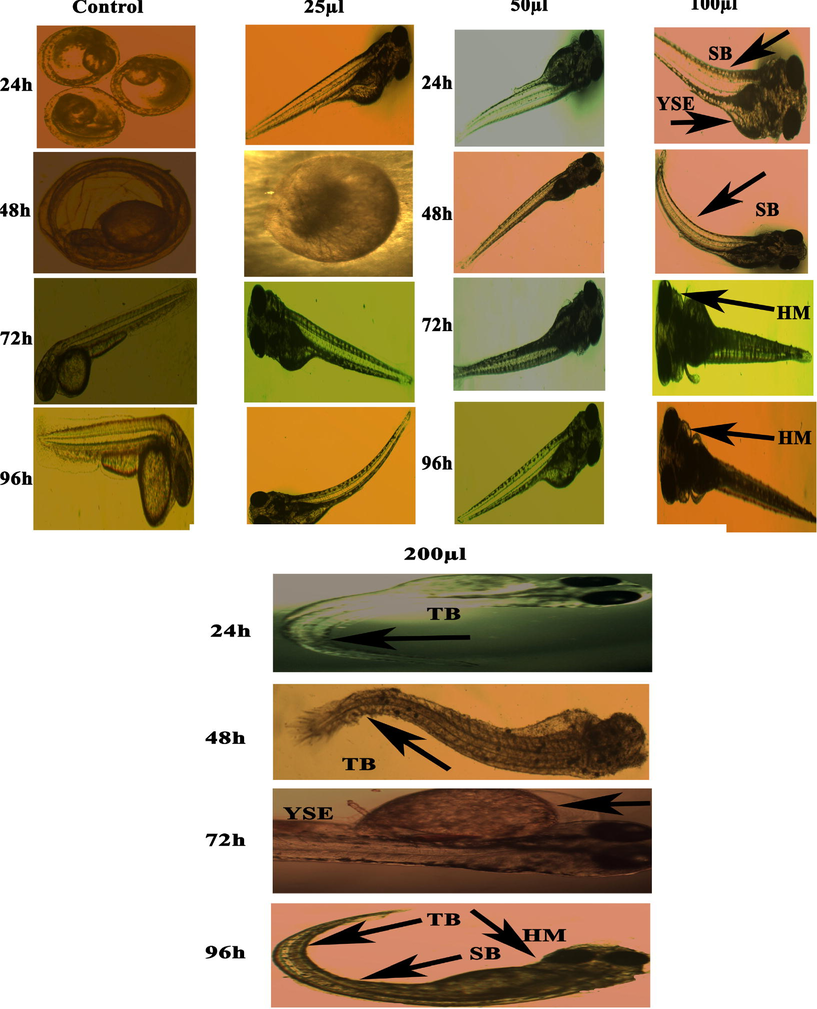 Representative images of zebrafish embryos and larvae exposed to FeCuONC. Control group shows the normal appearance for 24–96 hpf. Tail bent (TB), Yolk-sac edema (YSE) and head malformation (HM), and spinal card bend (SB) were markers of malformation caused by FeCuONC 24–96 hpf.