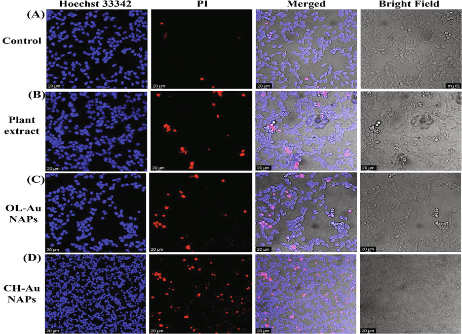 CLSM images of (A) untreated, and treated 293T cells with (B), plant extract (C), OL-Au NAPs, and (D) CH-Au NAPs.