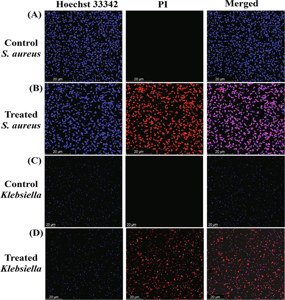 Live/dead stained images of Gram-positive and Gram-negative bacteria treated with green synthesized OL-Au NAPs.