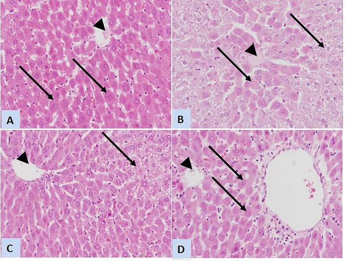 Representative photomicrographs of liver sections stained with H&E (×400) of control, PCM-intoxicated and treated rats. (A) Liver sections from control rats showing normal architecture of classic hepatic lobule with normal central vein (arrowhead) and normal hepatocytes (arrows). (B) Liver sections from rats received a toxic dose of PCM displays congested central vein with eosinophilic plasma (arrowhead) and degenerated and vacuolated hepatocytes (arrows). (C) Sections from rat treated with CoQ10 shows normal central vein (arrowhead) that surrounded by many normal hepatocytes except presence of few hepatocytes with cytoplasmic degeneration (arrow). (D) L-CoQ10 restored normal architecture of hepatic lobules and central vein (arrowhead), and almost all of hepatocytes appear of normal histological features (arrows).