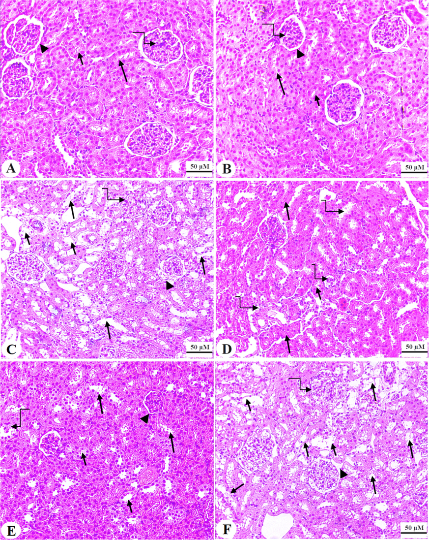 Haematoxylin and eosin (H&E) sections obtained for the renal tissues of all groups. A and B: were taken from control and ISL-treated rats and showed normal glomerulus mass (curved arrow) and glomerular membrane (arrowhead). In addition, both the proximal and distal tubules convoluted tubules (PCT & DCT) appeared normal and intact (short and long arrow, respectively). C: represents a DOX model rat and showed damaged glomerular membranes (arrowhead), loss of Bowman’s capsule space (curved arrow), and increased degeneration in both the PCT and DCT (short and long arrow, respectively). Note that increased number of tubular nuclei (curved arrow). D and E: represents ISL + DOX-treated rats and depict an obvious improvement in the structure of the glomerulus (arrowhead) and tubules (short and long arrow, respectively). However, degeneration in some PCT and DCT were also still seen (short and long curved arrows. F: represents an ISL + DOX + brusatol-treated animal and showed similar pathological changes like those observed in group C. 200x.