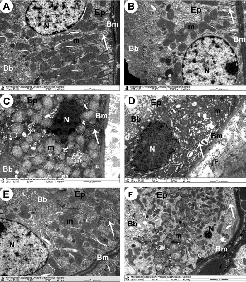 Transmission electron micrographs (TEM) of the renal tubules obtained from all experimental groups A&B: Control and control + ISL-treated rats, respectively, and showed normal epithelial cells (Ep), round nucleus (N), mitochondria (m), basement membrane (Bm), infolding membranes (arrow), and brush border (Bb). C: A DOX-treated rat and demonstrated necrotic epithelial cell (Ep), which showed pleomorphic swollen and damaged mitochondria (m) and irregular-shaped pyknotic nucleus (N). Damaged infolding membranes (arrow) and brush border (Bb), as well as basement membrane (Bm), were also seen. D: a DOX-treated rat showed increased collagen fibers (F) in the interstitial area between epithelial cells. Apoptotic epithelial cell (Ep) shows damaged mitochondria (m) and irregular-shaped pyknotic nucleus (N). Pleomorphic damaged infolding membranes (arrow) and brush border (Bb), as well as basement membrane (Bm), were also seen. E: a DOX + ISL-treated rat showed improvement in the structure of the majority of the organelles forming the renal tubular cells F: a DOX + ISL + brusatol rat showing similar ultrastructural changes seen in the renal in C. Scale bar = 2 µm. 10000X.