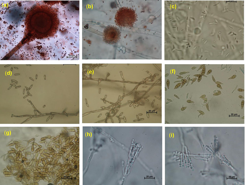 Microscopic image of pomegranate pathogenic fungi, a and b: conidiophore, conidial head and conidia of A. niger, c: conidia of F. oxysporium, d and e: conidiophore and conidia of F. chlamydosporum, f and g: conidia of A. alternata, h and i: conidiophore, philidia and conidia of P. implicatum.