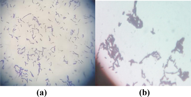 Gram staining of bacterial strains (a) GCU-DAB-TK-04, (b) HD500.