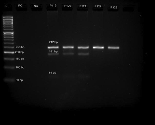 Agarose gel electrophoresis (3%) of polymerase chain reaction (PCR) product (PC-Positive Control; NC-Negative Control and P119-P123 Samples).