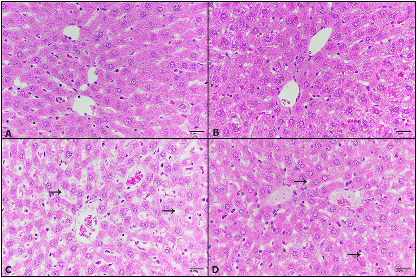 The effect of dandelion seeds extract on pathological changes cholesterol-induced in liver. Photomicrographs of mice liver (A) control liver showing normal hepatic structure (B) treated with 400 mg/kg dandelion seeds extract showing normal structure (C) treated with 5 mg/kg of cholesterol displaying dilated and congested vein, steatosis (black arrows), pyknotic nucleus (green arrow) (D) treated with 5 mg/kg cholesterol and 400 mg/kg dandelion seeds extract posting small micro-vesicular steatosis (black arrow). (H&E-400×).