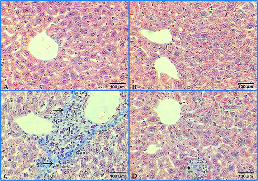 The effect of dandelion seeds extract to reduce the fibrosis and inflammation cholesterol-induced in liver. Photomicrographs of mice liver (A) control liver showing no fibrosis (B) treated with 400 mg/kg dandelion seeds extract showing no fibrosis (C) treated with 5 mg/kg of cholesterol displaying accumulation of collagenous fibers (black arrows), inflammatory cells (I) (D) treated with 5 mg/kg cholesterol and 400 mg/kg dandelion seeds extract posting small foci of fibrosis with a few number of inflammatory cells (black arrow). (M.Tr-400×).