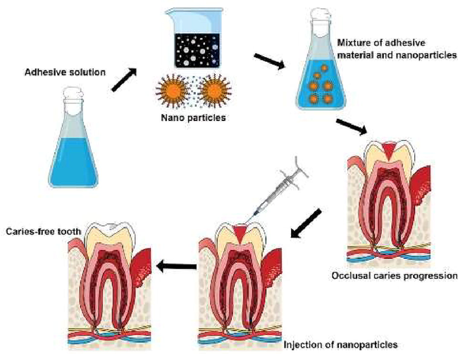 Potential uses of metal nanoparticles in dental treatment.