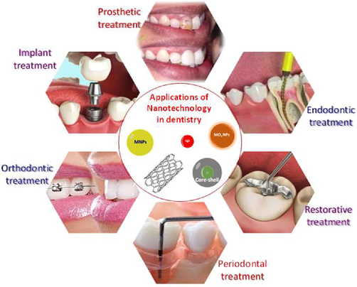 Applications of nanomaterials in different fields of dentistry.