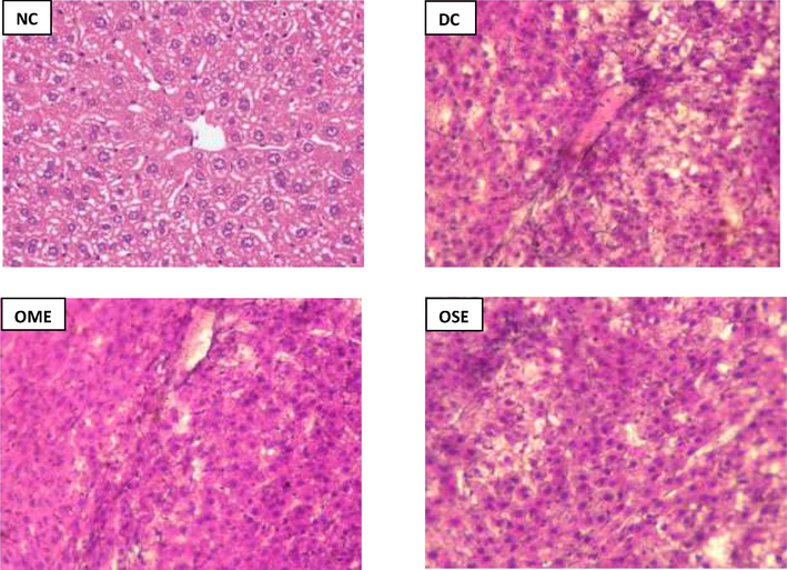 Histopathology of Liver. NC: Normal control, DC: Diabetic Control, OME: Okra mucilage extract, and OSE: Okra seed extract. Images were acquired using a magnification of 40X.