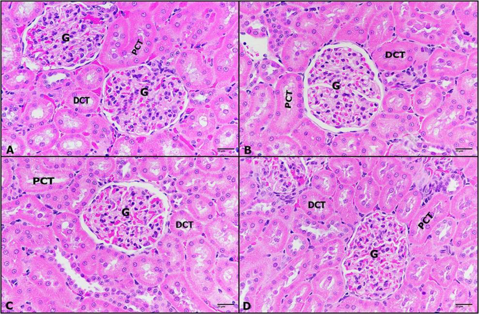 A-D: Photomicrographs of rat kidney sections untreated control (A), (0.25 mg/kg) IVM- treated group (B), (0.50 mg/kg) IVM- treated group (C), and (1 m g/kg) IVM- treated group (D) showing demonstrating normal histological architecture with normal glomeruli (G), normal tubular cells of proximal convoluted tubules (PCT) and distal convoluted tubules (DCT) associated with normal interstitial tissue structure. (H&E-400×).