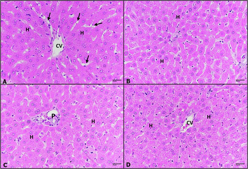 A–D: Photomicrographs of rat liver sections, untreated control (A), (0.25 mg/kg) IVM- treated group (B), (0.50 mg/kg) IVM- treated group (C), and (1 m g/kg) IVM- treated group (D) showing normal hepatic architecture with normal central vein (CV), hepatic strands of hepatocytes (H) with well-defined nuclei and cytoplasm, radiate from the central vein towards the periphery of the hepatic lobules and portal triads (P) and are separated by narrow blood sinusoids (arrows). H & E; 400 ×.