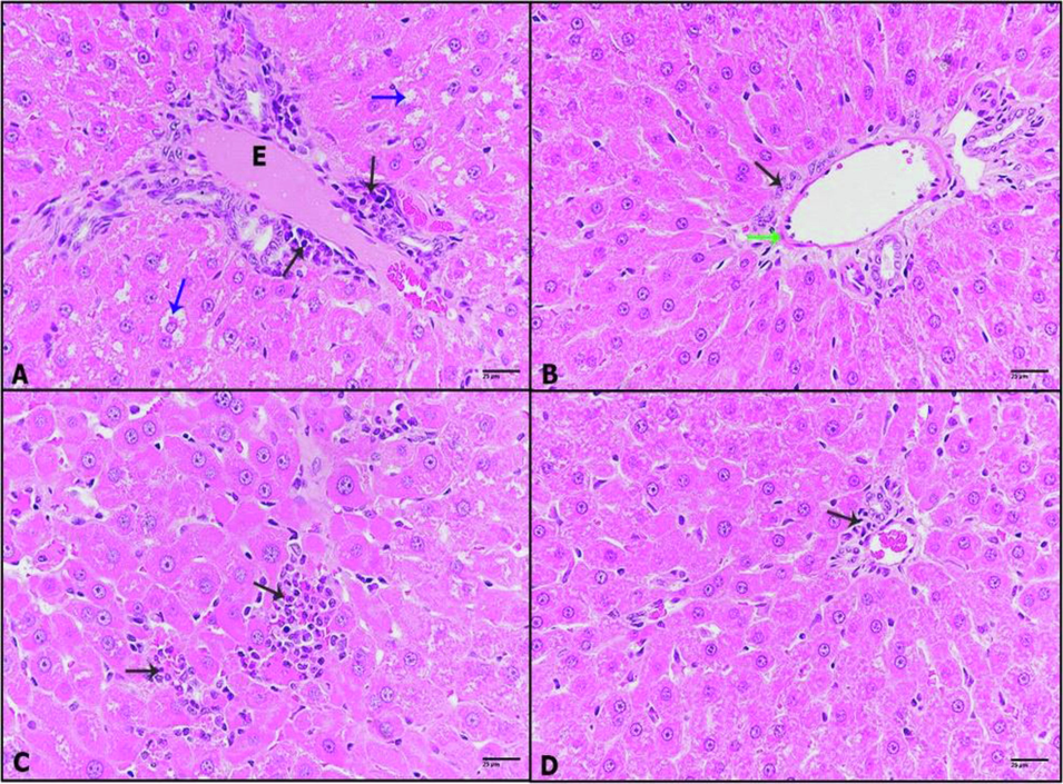 A-D: Photomicrographs of liver sections of (A): DHM-treated rats showing dilatation of congested blood vessel with inflammatory cells (black arrow), cytoplasmic degeneration of hepatocytes (blue arrows). (B): 0.25 mg/kg IVM plus DHM-treated rats displaying thickened vein wall (green arrow), a few inflammatory cells (black arrow). (C): 0.50 mg/kg IVM plus DHM-treated rats illustrating small foci of inflammation (black arrow). (D): 1 mg/kg IVM plus DHM-treated rats displaying healthy tissue with a very few inflammation foci (black arrow), (H&E-400×).