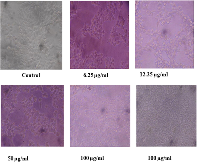 Morphological changes in MCF – 7 cell lines treated with AgNPs at different concentration.