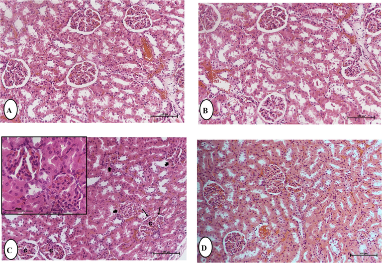 Histological examinations by hematoxylin and eosin staining demonstrating the effect of Boldine (BOL) on Methylprednisolone (MPL) induced kidney damage in rats. Light micrographs of the kidney of control (A) and treated group; (B) BOL 50 mg/Kg b.w./ day, showing the normal renal glomeruli, and renal tubules lined by tubular cells with vesicular nuclei. (C) MPL showing loss of normal histological structure, glomerular (G) congestion, swelling of the glomerular (), cellular degeneration, all of which are associated with decreased luminal spaces (), blood congestion, and increase in pyknotic and karyorrhectic debris in necrotic tubules. (D) BOL (50 mg/kg) + MPL, showing reduced renal damage and regain of typical architecture to a small extent with less renal tubular epithelium degeneration. (H and E), Original magnification is ×40, (scale bar 50 µm).