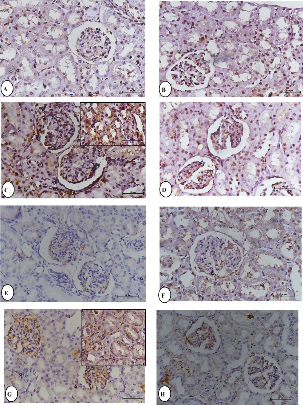 Immunohistochemical staining for P53 and TNF-α expression in the kidney section, the expression of P53 observations in: (A) Normal control rats. (B) Boldine BOL (50 mg/kg) rats. (C) Methylprednisolone MPL (100 mg/kg b.w). (D) BOL (50 mg/kg) + MPL (100 mg/kg b.w) rats at 24 h. The expression of TNF-α observation in: (E) Normal control rats. (F) Boldine BOL (50 mg/kg) rats. (G) Methylprednisolone MPL (100 mg/kg b.w). (H) BOL (50 mg/kg) + MPL (100 mg/kg b.w) rats at 24 h.