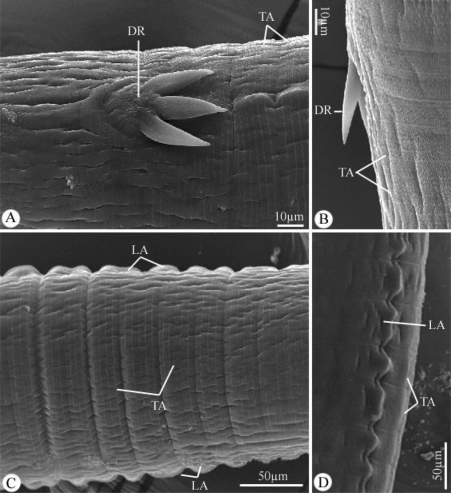 Scanning electron micrographs of Desportesius invaginatus showing different parts in the middle region of the body. Note: DR, deirids; TA, transverse annulations; LA, lateral alae.