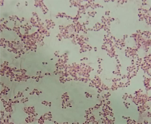 Gram positive Bacilli (spores).