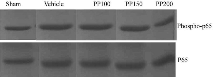 Upregulation of NF-jB subunits (p65 and phospho-p65) after 24 h reperfusion and the inhibitory activity of PP in Albino rat. Activation of p65 was observed after 24 h reperfusion treatment.