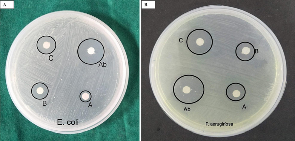 Photograph of petri dishes with loaded samples of A. nervosa mediated AgNPs against (a) E. coli, (b) p. aeruginosa. Ab-antibiotic drug (30 μl), a-10 μl, b-20 μl, c-30 μl concentrations.