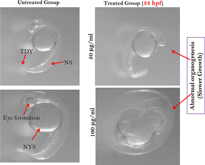 Zebrafish embryos after 33 hpf exposed to dries fish treatments. Here, TDY- tail detached from yolk sac; NS- normal spine and NYS- normal yolk sac.