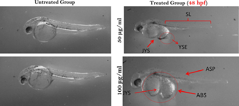 Zebrafish embryos after 48 hpf exposed to dried fish treatments. Here, SL- shorter length; JYS- joint yolk sac; YSE- yolk sac edema; ASP- abnormal skin pigmentation and ABS- abnormal body shape.