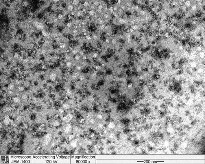 TEM images of SHMP-induced trypsin aggregates. Trypsin (8.3 μM) was treated with 1 mM SHMP at pH 6.0.