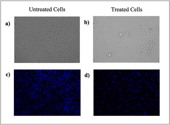 Morphological changes in T47D cells exposed to 200 µg/mL AgNP-OFE for 24 h detected using bright field microscopy and fluorescence microscopy. (a) morphological changes in untreated cells (control), (b) morphological changes in treated cells, (c) DAPI staining of untreated cells, and (d) DAPI staining of treated cells.