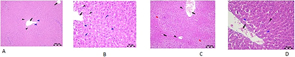 Histopathological analysis of liver tissue of rat.