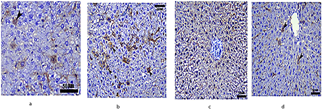 Immunohistochemical expression of NF-κB in the liver of rats.