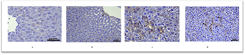 Immunohistochemical expression of TGF-β in the liver of rats.