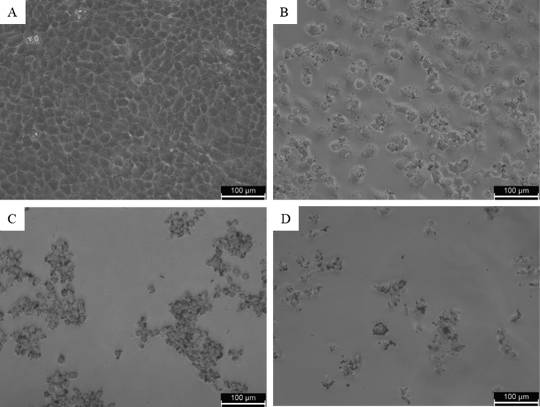 Morphology of NRK52E cells following exposure to CuO-rGO NCs for 24 h. (A) untreated control, (B) cells treated with 25 µg/ml, (C) 50 µg/ml, and (D) 100 µg/ml. NRK52E: Normal rat kidney cells and CuO-rGO NCs: Copper oxide-reduced graphene oxide nanocomposites.