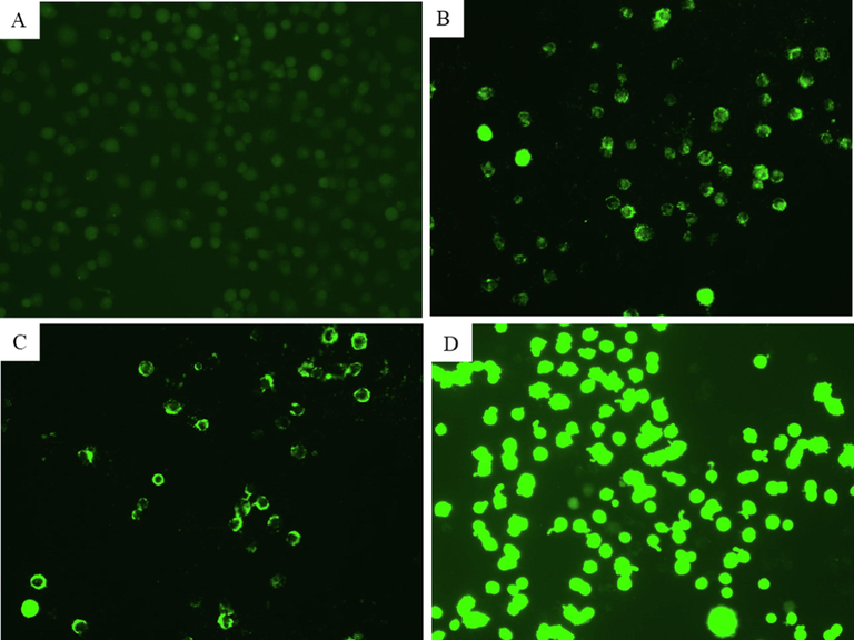 Fluorescence microscopic observation of intracellular ROS generation in NRK52E cells following exposure to different concentrations of CuO-rGO NCs for 24 h. (A) Control cells. (B) Cells treated with 10 µg/ml of CuO-rGO NCs. (C) Cells treated with 25 µg/ml of CuO-rGO NCs. (D) Cells treated with H2O2 for positive control. ROS: Reactive oxygen species, NRK52E: Normal rat kidney cells and CuO-rGO NCs: Copper oxide-reduced graphene oxide nanocomposites, and H2O2: Hydrogen peroxide.