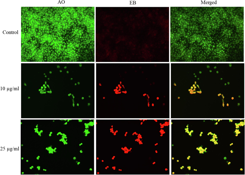 Fluorescence microscopic observation of acridine orange/ethidium bromide (AO/EB) dual staining of NRK52E cells following exposure to different concentrations of CuO-rGO NCs for 24 h. CuO-rGO NCs induced apoptosis in NRK52E cells evident by the presence of orange-red stained cells in treated groups, whereas control cells appears as green. AO/EB: Acridine orange/ethidium bromide, NRK52E: Normal rat kidney cells and CuO-rGO NCs: Copper oxide-reduced graphene oxide nanocomposites.