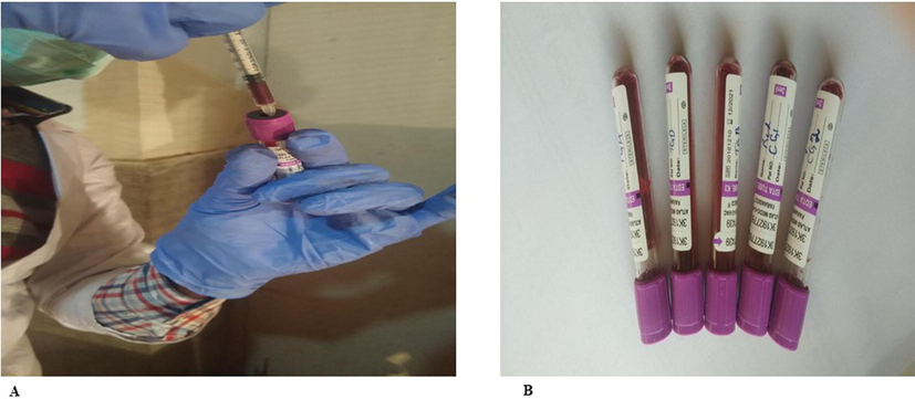 (a) Blood sampling of chickens from each category after every 7 days interval. (b) Blood samples in EDTA vials.