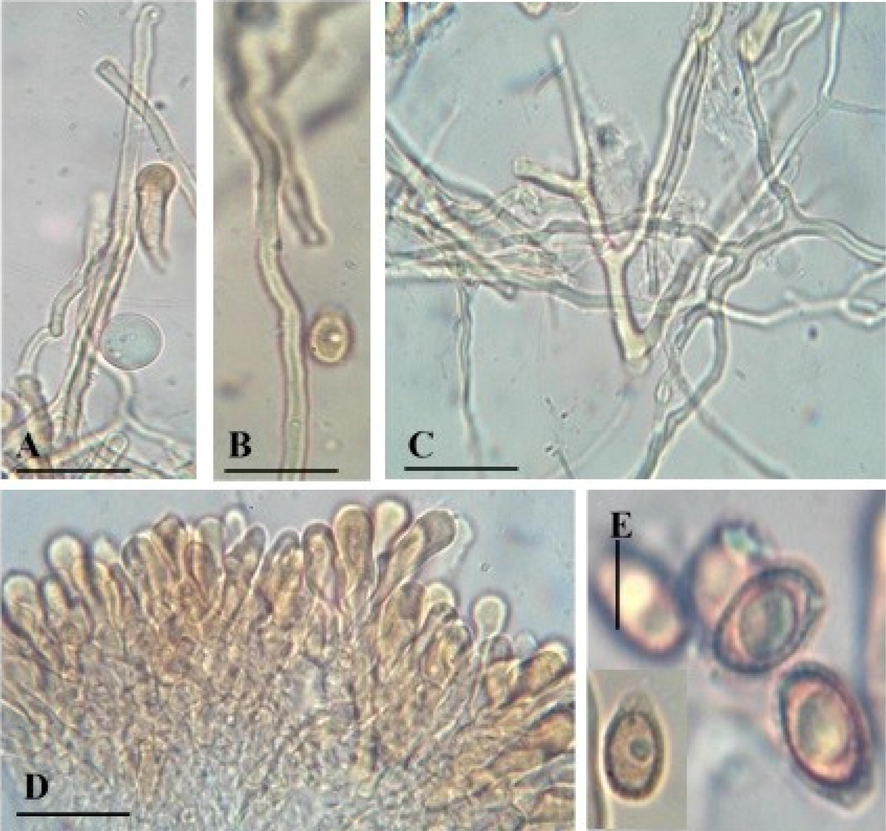 Microscopic structures of Ganoderma multistipitatum (A–E GCB101). A-C. Hyphae (A. Generative), (B. Skeletal), (C. Binding). D. Cells of crustohymeniderm. E. Basidiospores. Bars = 5 μm (A–C), 10 μm (D–E).