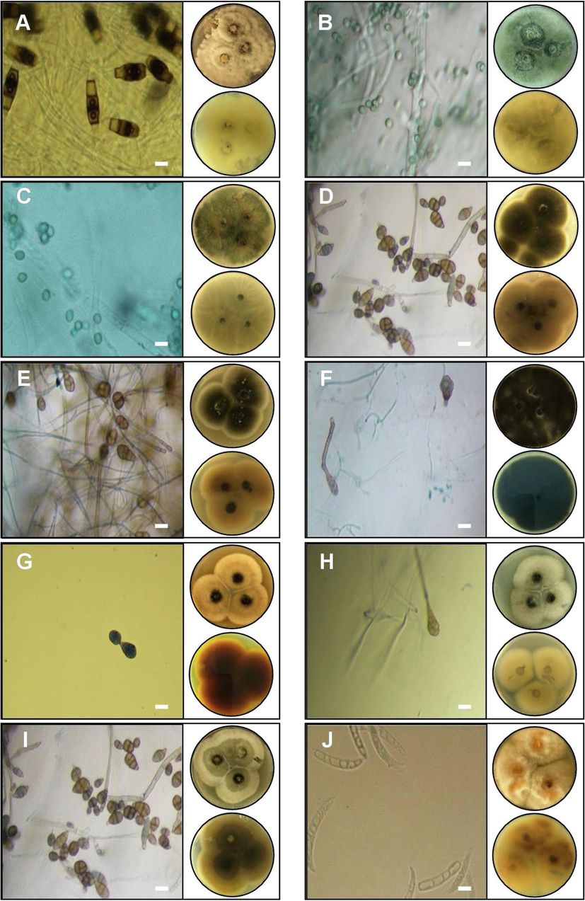 Macroscopic and microscopic features of five genera of fungal endophytes: A- Neopestalotiopsis clavispor, B- Trichoderma virens, C- Fusarium sp., D- Alternaria eichhorniae, E- Alternaria alternata, F- Alternaria alstroemeriae, G- Curvularia subpapendorfii, H- Penicillium glabrum, I- Alternaria tenuissima, and J- Fusarium equiseti. Images of Petri dishes in each panel represent pictures from the upper and lower side. The length of the scale bar is 20 µm.